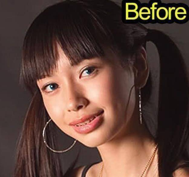 {百家樂}(angelababy整容前 照片)